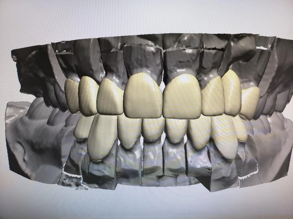 Pacific Dental Care gallery photo 5