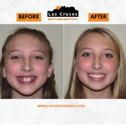 Las Cruces Orthodontics gallery photo 5