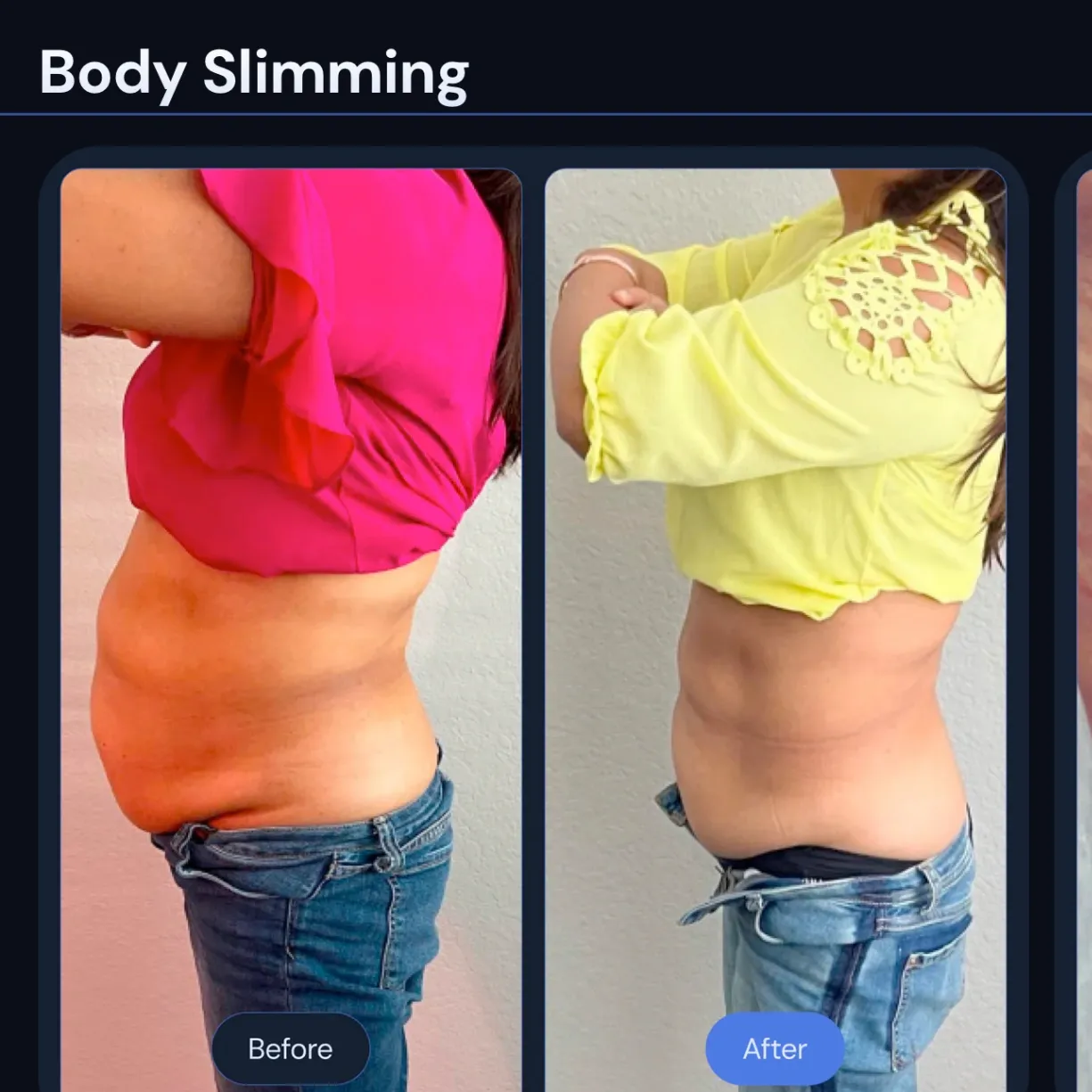 infraSCULPT of Oklahoma gallery photo 2