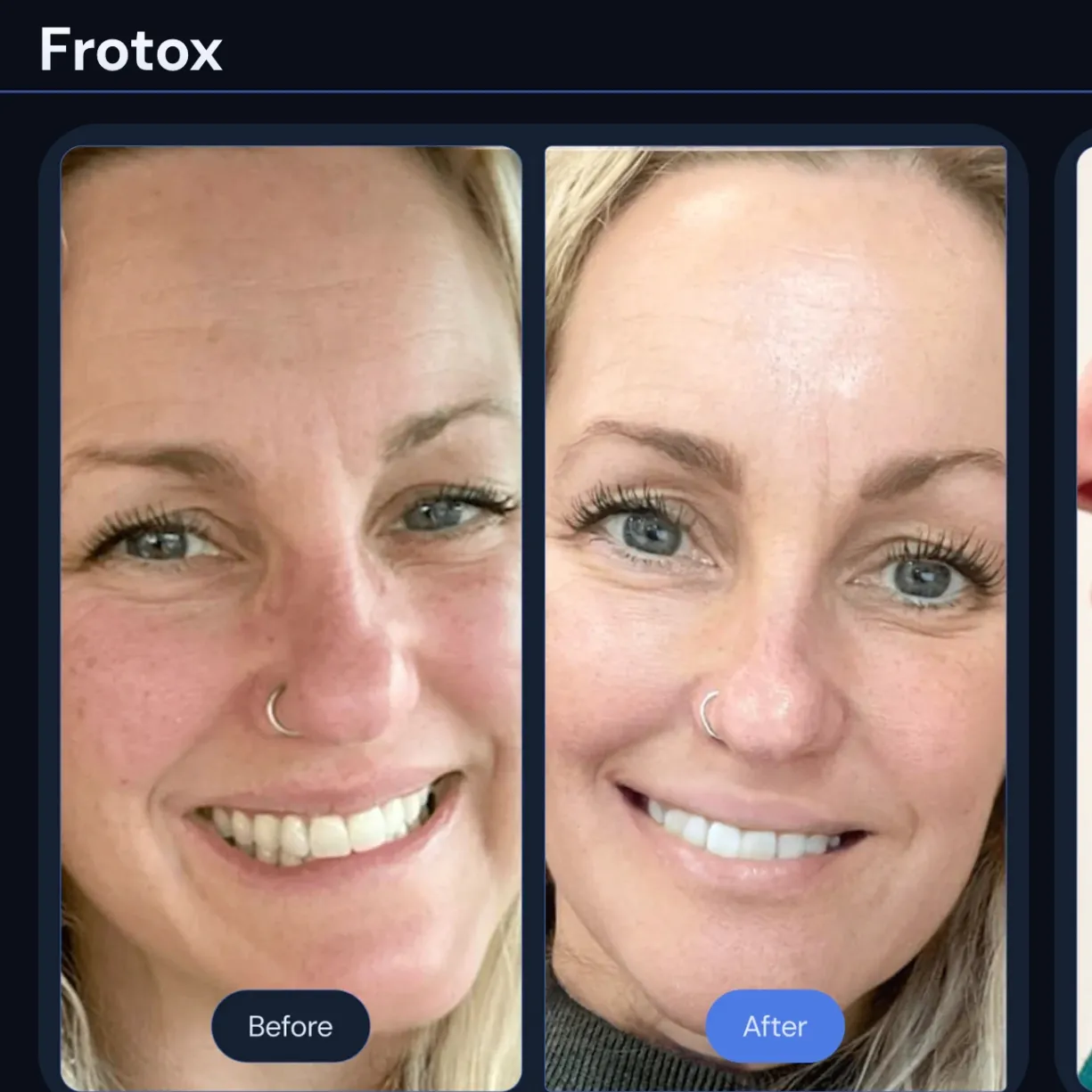 infraSCULPT of Oklahoma gallery photo 3